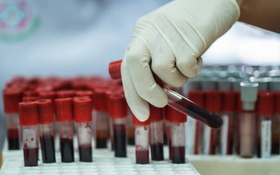 Detectarea timpurie a bolilor, un deziderat al medicinei moderne, devine tot mai vital în contextul tot mai alert al vieții cotidiene