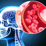 Suplimentul poate diminua cu 43% riscul de infarct și AVC