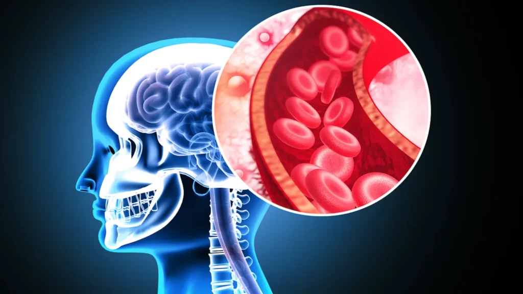Suplimentul poate diminua cu 43% riscul de infarct și AVC