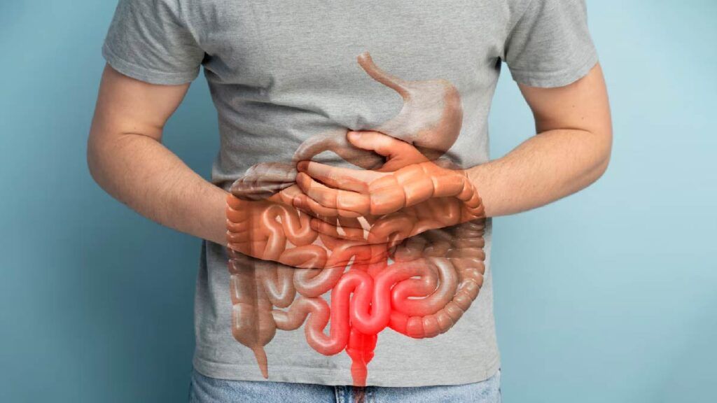 Medici oncologi: un superaliment ieftin poate reduce riscul de cancer de colon
