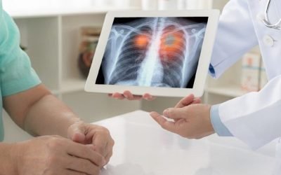 Numărul cazurilor de automedicație periculoasă din România a crescut alarmant în ultimii ani, iar medicii trag un semnal de alarmă privind fenomenul tot mai frecvent al introducerii obiectelor neconvenționale în rect