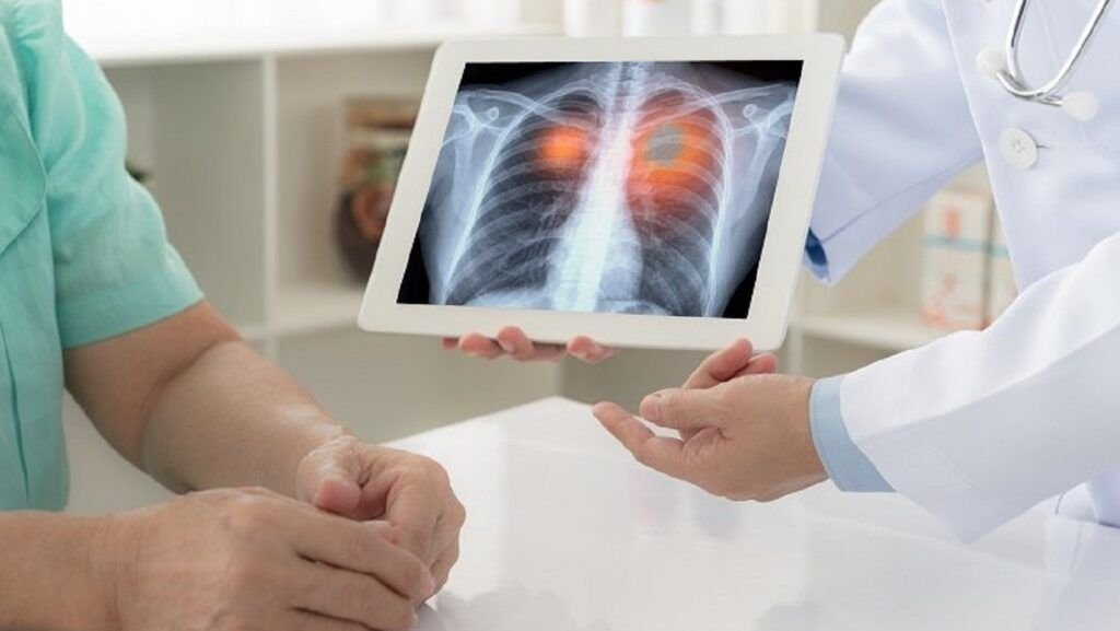 Numărul cazurilor de automedicație periculoasă din România a crescut alarmant în ultimii ani, iar medicii trag un semnal de alarmă privind fenomenul tot mai frecvent al introducerii obiectelor neconvenționale în rect