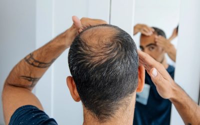 Premieră în medicina regenerativă: cercetătorii au reușit să reconstruiască, din celule, foliculi de păr funcționali în laborator, o descoperire care ar putea revoluționa tratamentele împotriva căderii părului