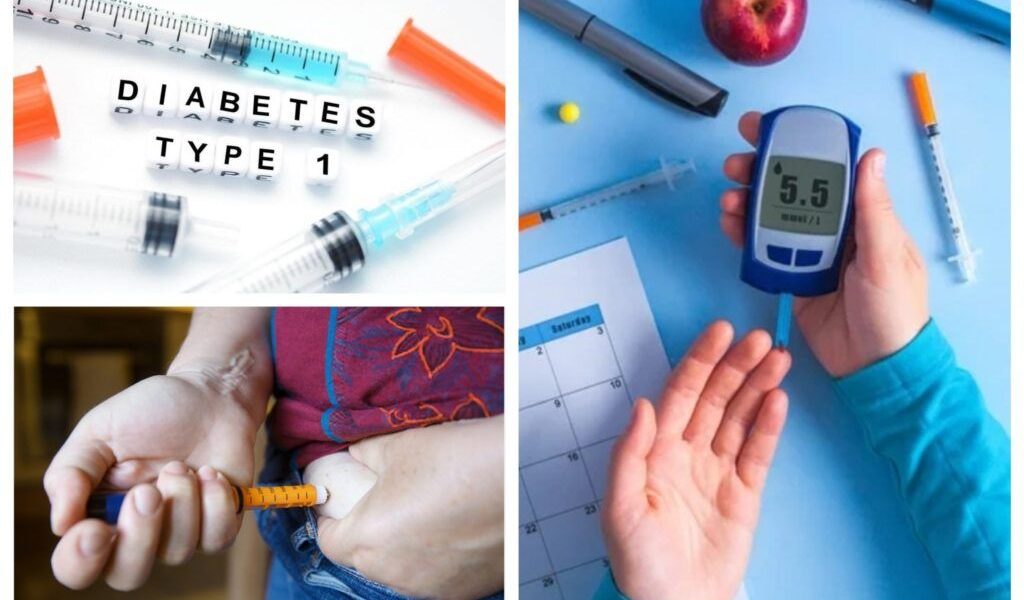 Procedeu inovator ce elimină necesitatea insulinei în diabetul de tip 1