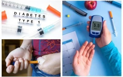 Procedeu inovator ce elimină necesitatea insulinei în diabetul de tip 1