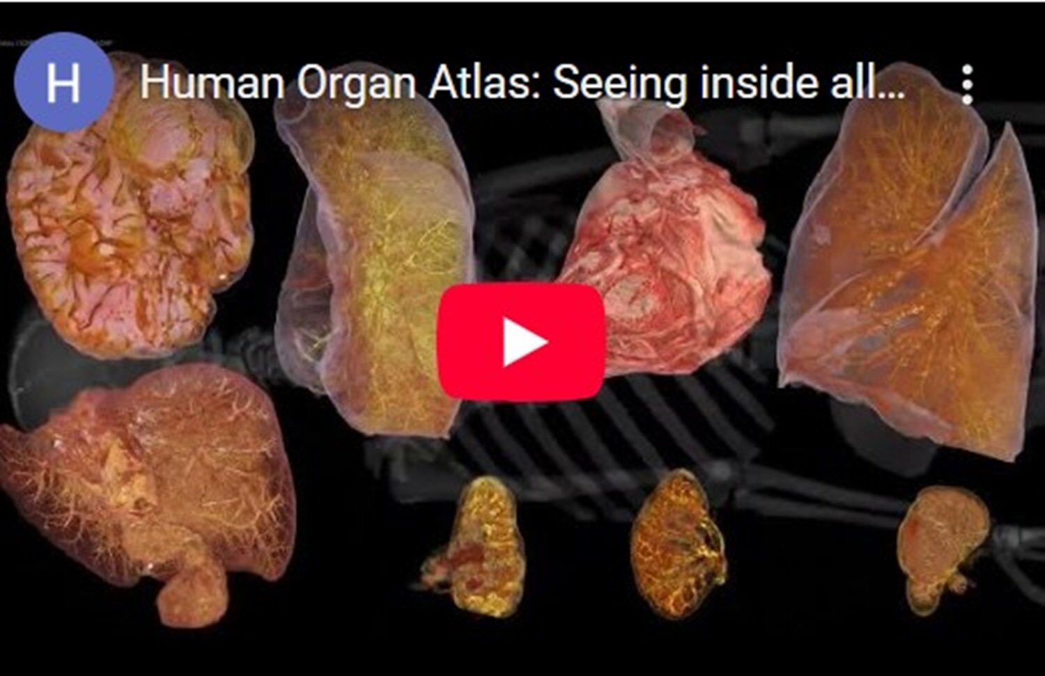 Un progres remarcabil în lumea imagisticii biomedicale: un atlas digital al organelor umane, vizualizabil direct din browser Prezentat ca o revoluție în studiul anatomiei și diagnosticul medical, un proiect derulat pe parcursul a șase ani aduce în actualitate o noțiune de până acum doar teoretică