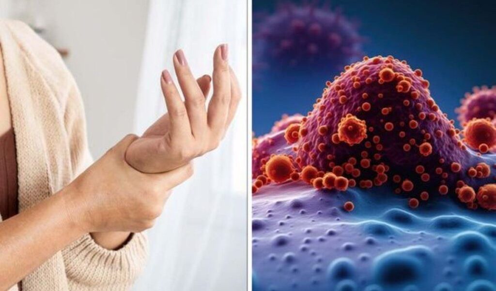 10 semne aparent banale care pot indica prezența cancerului