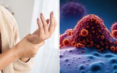 10 semne aparent banale care pot indica prezența cancerului