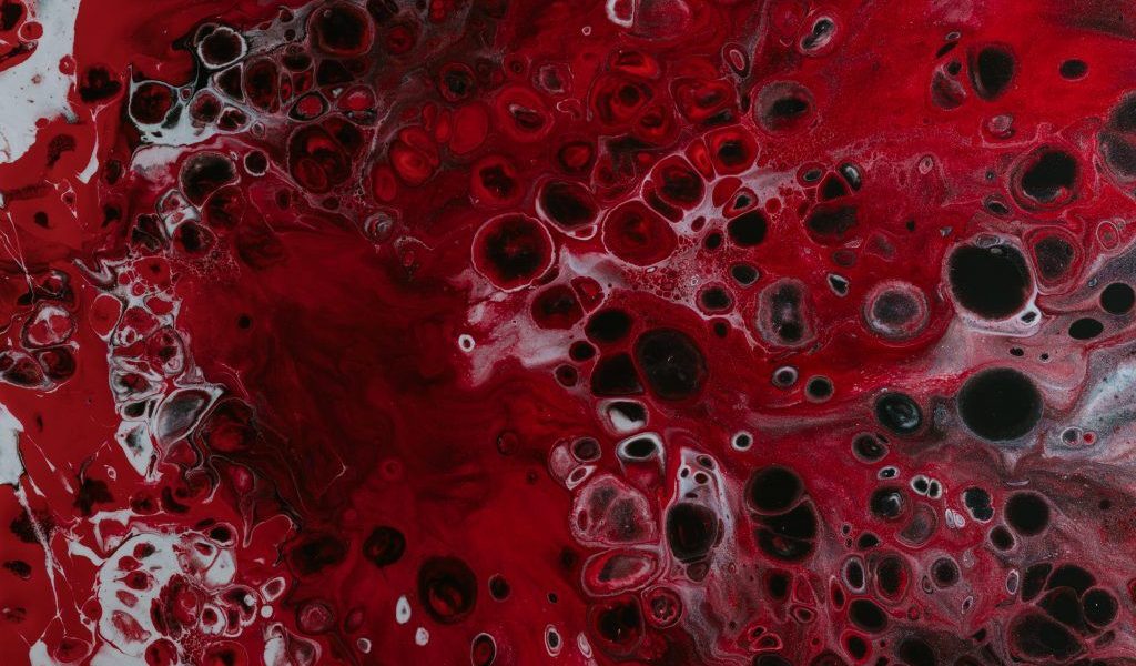 Anemia feriprivă, cea mai frecventă formă de anemie la nivel global și național, reprezintă o problemă de sănătate publică ce afectează milioane de români