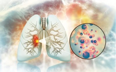 Cancerul de plămâni la nefumători: Legătură ȘOCANTĂ cu fructele și legumele