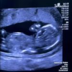 Gravidă, trimisă la tratament în Germania după o experiență HALUCINANTĂ la Filantropia, București