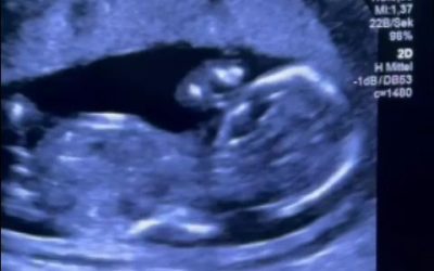 Gravidă, trimisă la tratament în Germania după o experiență HALUCINANTĂ la Filantropia, București