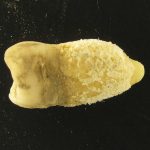 Bacterie de scarlatină, găsită într-o mumie: Misterele Americii Precolumbiene dezvăluite