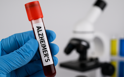 Un test de sânge simplu, bazat pe măsurarea nivelului proteinei p-tau217, ar putea identifica riscul de demență cu decenii înainte de apariția simptomelor clinice, conform unor cercetări recente