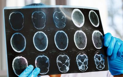 Asociațiile de pacienți cer intervenția Ministerului Sănătății și CNAS după scăderea cu 47% a investigațiilor de monitorizare