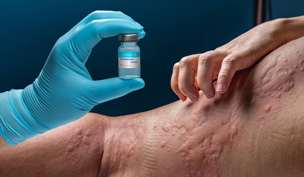 Între 55-70 de caractere, captivant, direct O tânără cu peste 40 de alergii, mănâncă un măr după 10 ani datorită unui tratament pentru astm