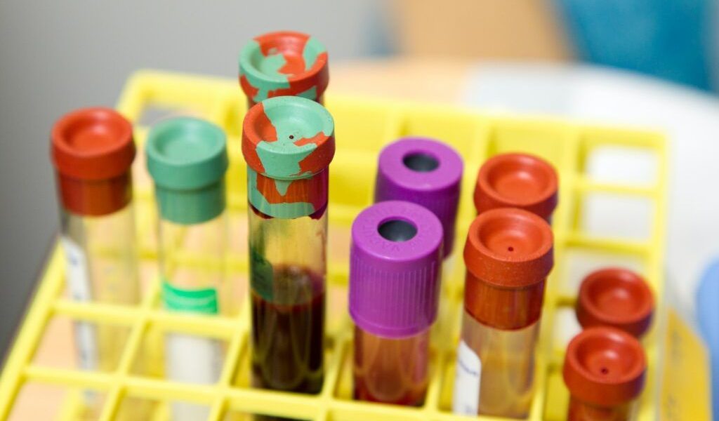 Cât costă analizele în 2026 pentru românii fără asigurare Medicală? Diferențe colosale!