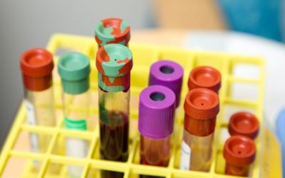 Cât costă analizele în 2026 pentru românii fără asigurare Medicală? Diferențe colosale!