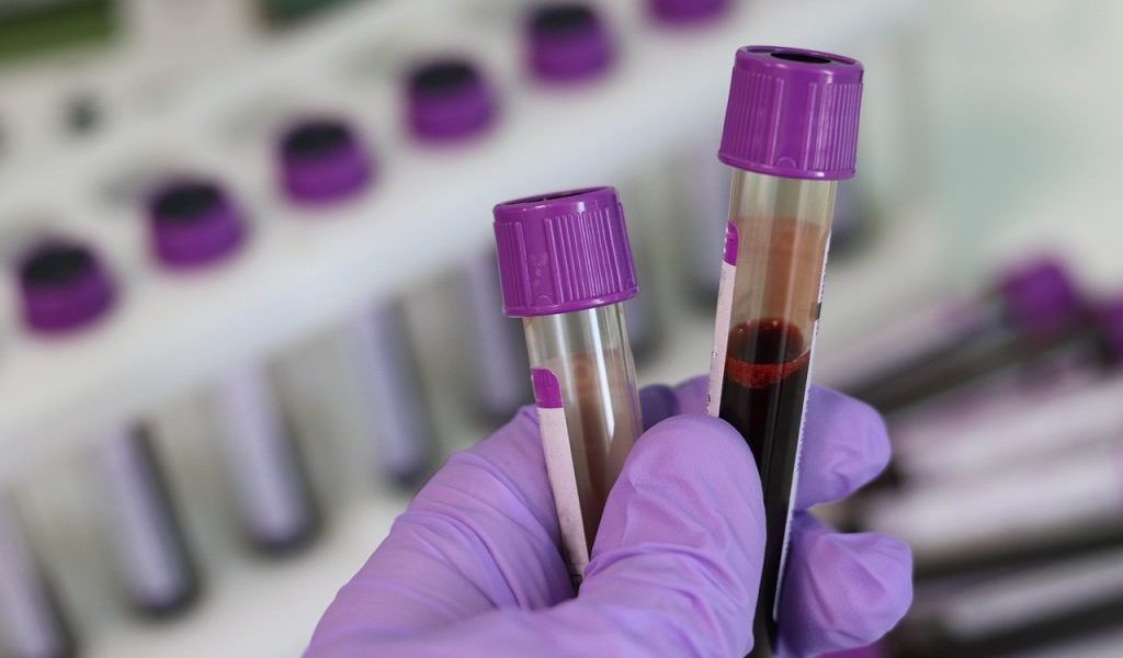 Analiză de sânge revoluționară: depistează cancerul înainte de simptome!