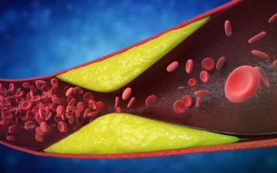 7 semne subtile ale arterelor blocate: Cardiologii avertizează, mulți le ignoră