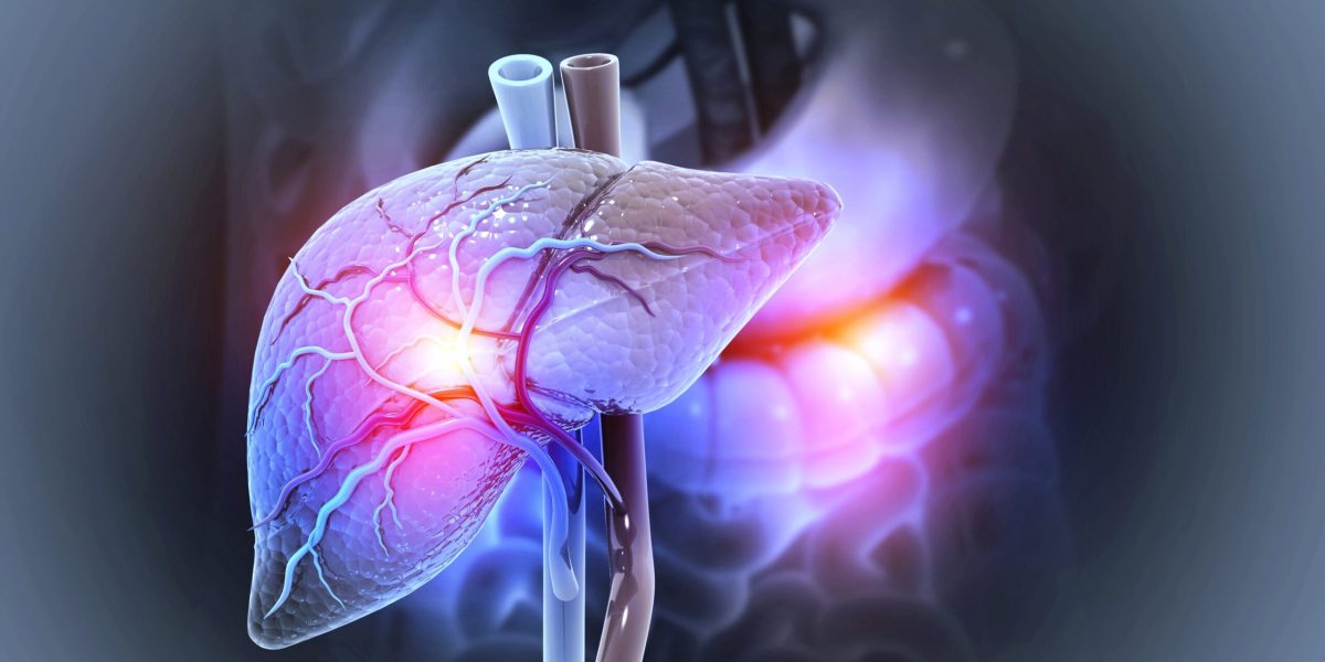 Boala ficatului gras, pandemie ascunsă: 1,8 miliarde de oameni, în pericol până-n 2050