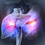 Boala ficatului gras, pandemie ascunsă: 1,8 miliarde de oameni, în pericol până-n 2050