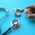 Tineri loviți de CANCER de colon: Ce se întâmplă la nivel global?