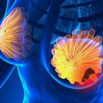 Uite CE semne NU trebuie ignorate: TOP 5 simptome ale cancerului de sân