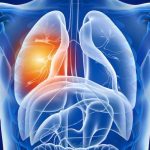 Plămânii, afectați grav după COVID-19: Ce efecte ascunse apar