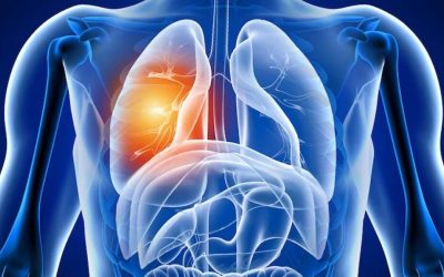 Plămânii, afectați grav după COVID-19: Ce efecte ascunse apar