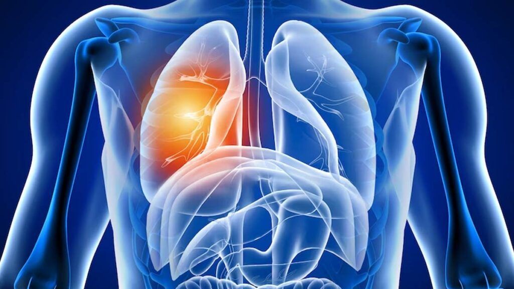 Plămânii, afectați grav după COVID-19: Ce efecte ascunse apar