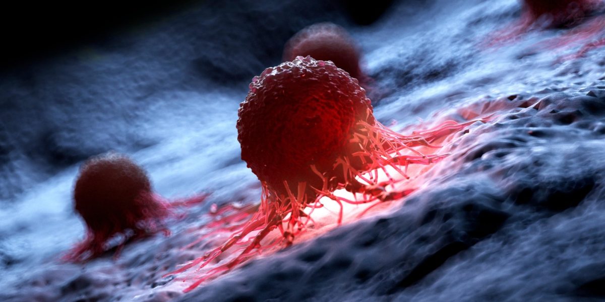 Nouă terapie anti-cancer: Rezultate promițătoare într-un studiu preliminar