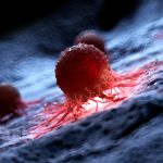 Nouă terapie anti-cancer: Rezultate promițătoare într-un studiu preliminar