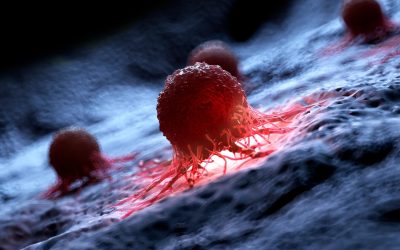 Nouă terapie anti-cancer: Rezultate promițătoare într-un studiu preliminar