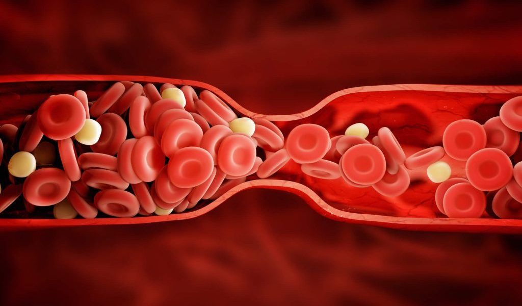 Alarmă: Semne ascunse în mâini, risc de cheaguri de sânge