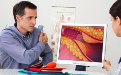 Cardiologii din SUA lansează ghiduri recente pentru gestionarea colesterolului ridicat Cardiologii de top din Statele Unite au publicat noi ghiduri pentru gestionarea colesterolului ridicat, aducând recomandări actualizate menite să reducă riscul de infarct, accident vascular cerebral și alte boli cardiovasculare grave