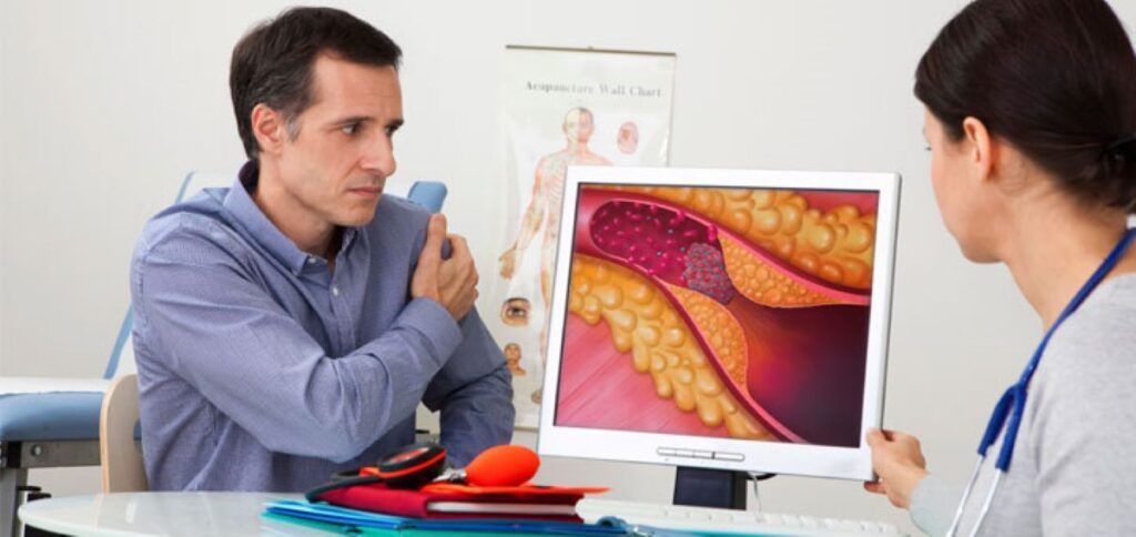 Noul ghid pentru colesterol: ce sfătuiesc cardiologii americani despre risc de infarct și AVC