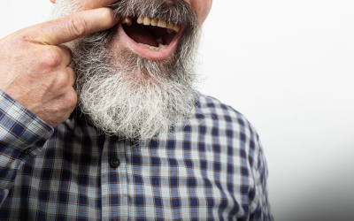 Pacienții cer dinți noi rapid, fără compromisuri: ce soluții există?