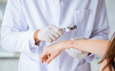 Ectima: Cauze, simptome și tratament eficient. Sfaturi de la medici pentru sănătate