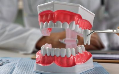 Extracție vs. fără: Ortodonția pune medicii la încercare. De ce aleg?