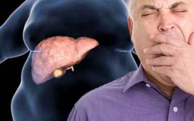 Tratament revoluționar pentru ficatul gras: dietă neschimbată, rezultate uimitoare!