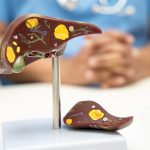 Boala SILENTIOASĂ ce distruge tinerii: Pericolul ascuns al stilului de viață modern