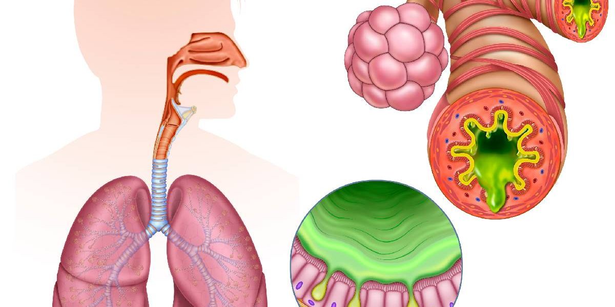Inflamația cronică, „dușmanul invizibil”: Cum ne afectează sănătatea, azi