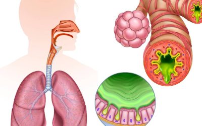 Inflamația cronică, „dușmanul invizibil”: Cum ne afectează sănătatea, azi