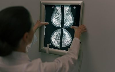 Depistarea precoce a cancerului de sân salvează vieți, iar realizarea investigațiilor de rutină, precum ecografia și mamografia, trebuie să fie prioritate pentru femeile din toate grupele de vârstă