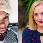 Cancer intestinal la 44 de ani: Medicii, în alertă. Ce factori suspectează?