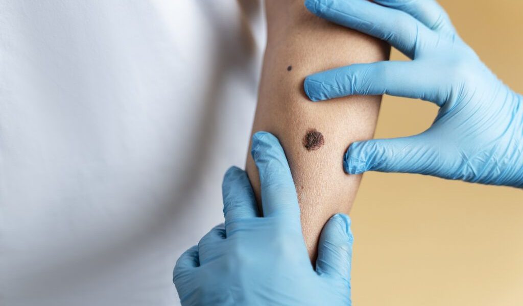 O aluniță fatală: O femeie moare după o simplă intervenție