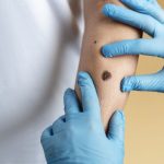 O aluniță fatală: O femeie moare după o simplă intervenție