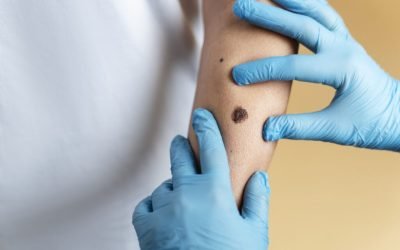 O aluniță fatală: O femeie moare după o simplă intervenție