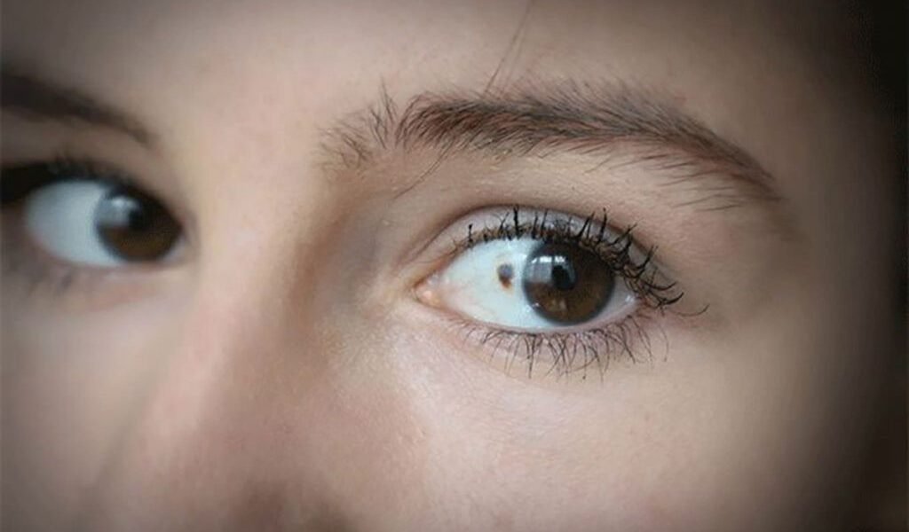 Avertisment: 11 semne că cancerul se instalează sub ochii tăi